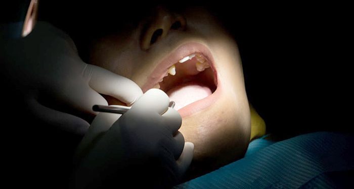 Safari Dental Care RSKGM Bandung Layani Pemeriksaan Gigi Gratis di 30 Kecamatan